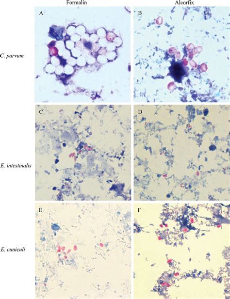 alcorfix|Cryptosporidium and Coccidia Exam, Fecal